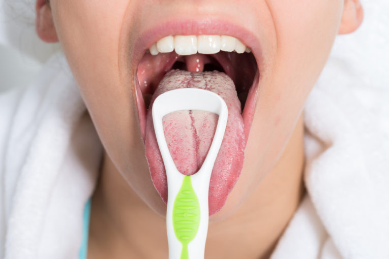 how-to-cure-dry-mouth-naturally-why-dry-mouth